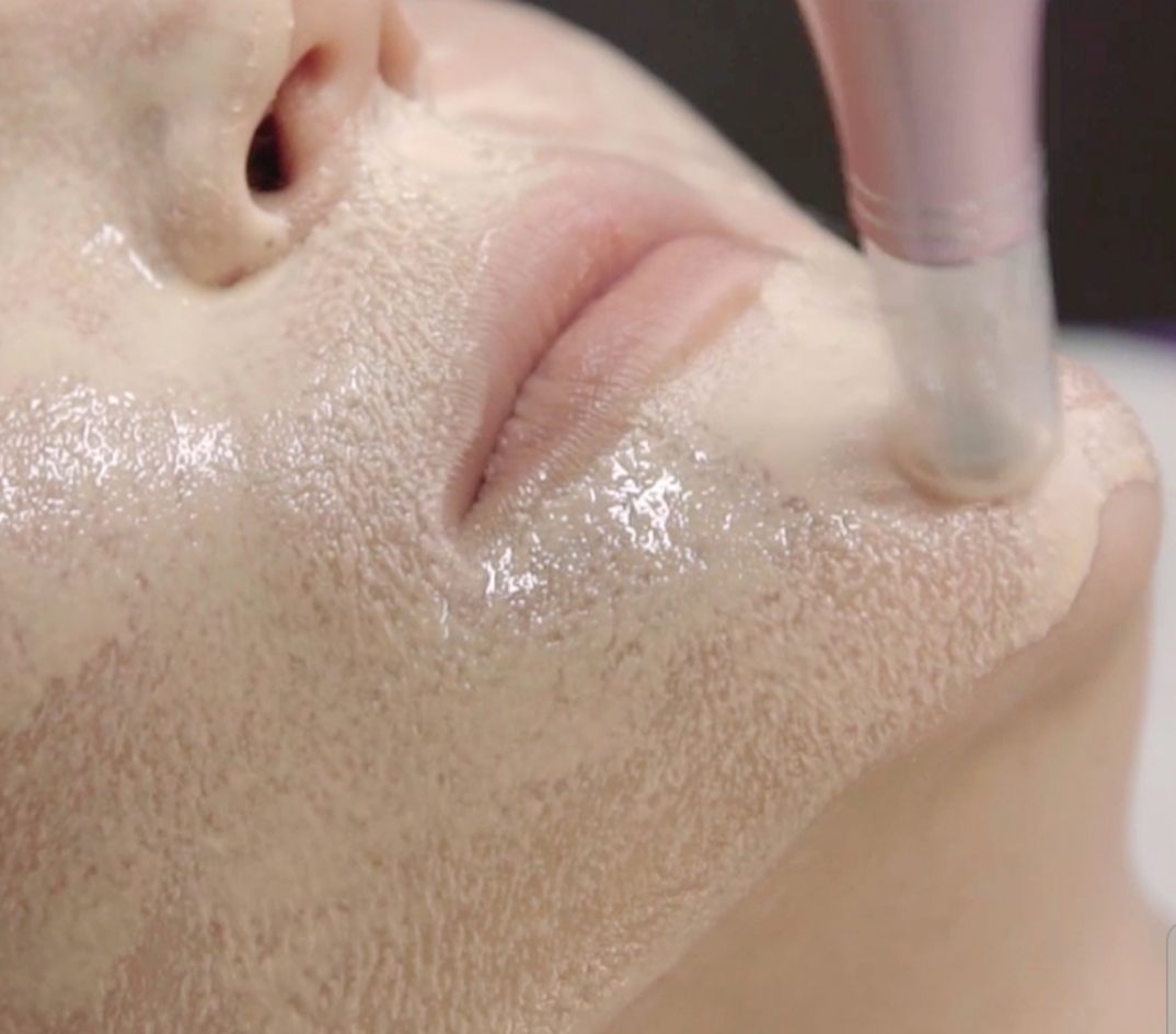 is glutathione treatment permanent Glutathione Benefits for Skin: Brightening, Anti-Aging, and More main image 0