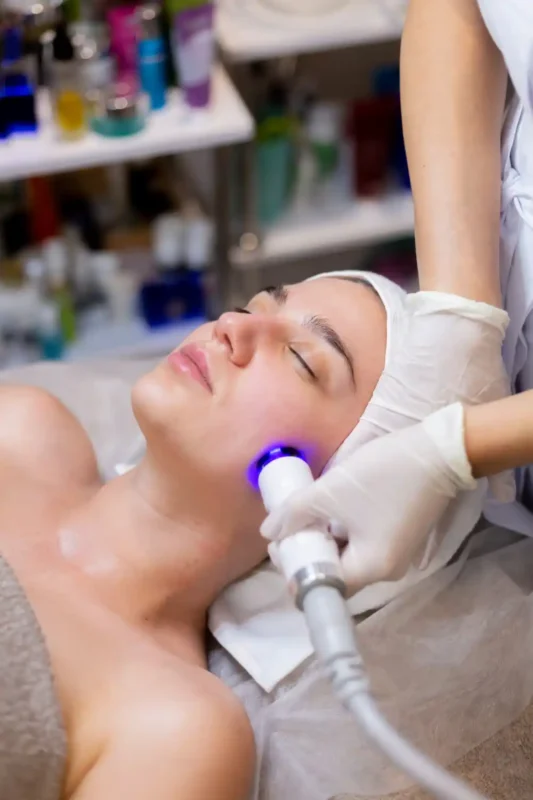 Laser melasma treatment for facial pigmentation in Glasgow