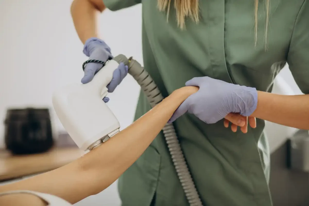 Laser vascular treatment for thread vein removal on the face